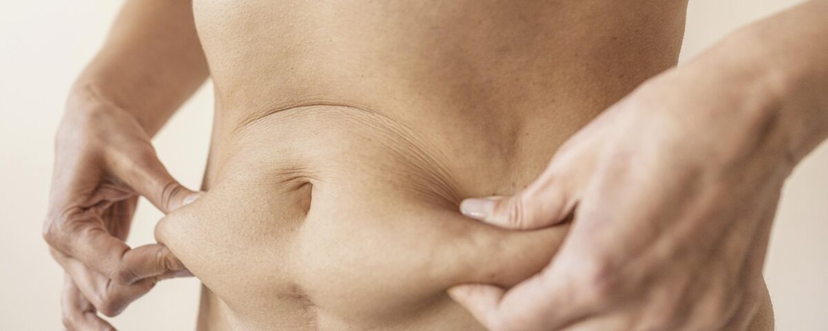 Liposukcja brzucha – fakty i mity o modelowaniu sylwetki
