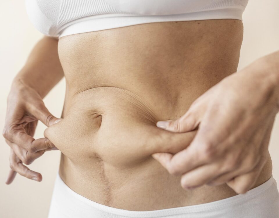 Liposukcja brzucha – fakty i mity o modelowaniu sylwetki